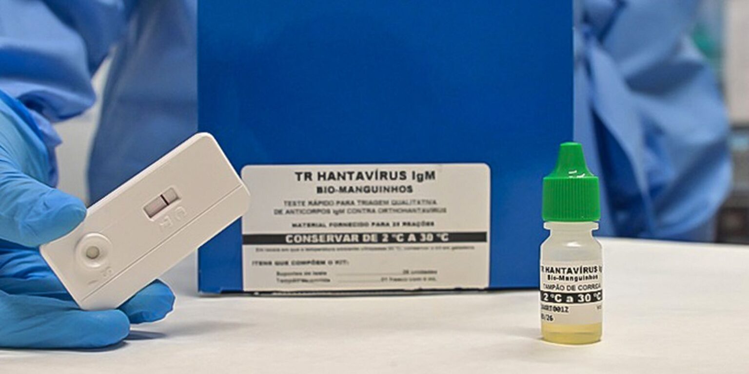 Teste de hantavirose detecta doença em 20 minutos, diz Anvisa