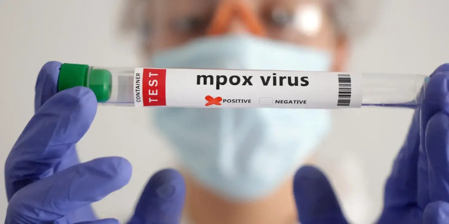 Mpox grupo lp: São Paulo confirma segundo caso da variante