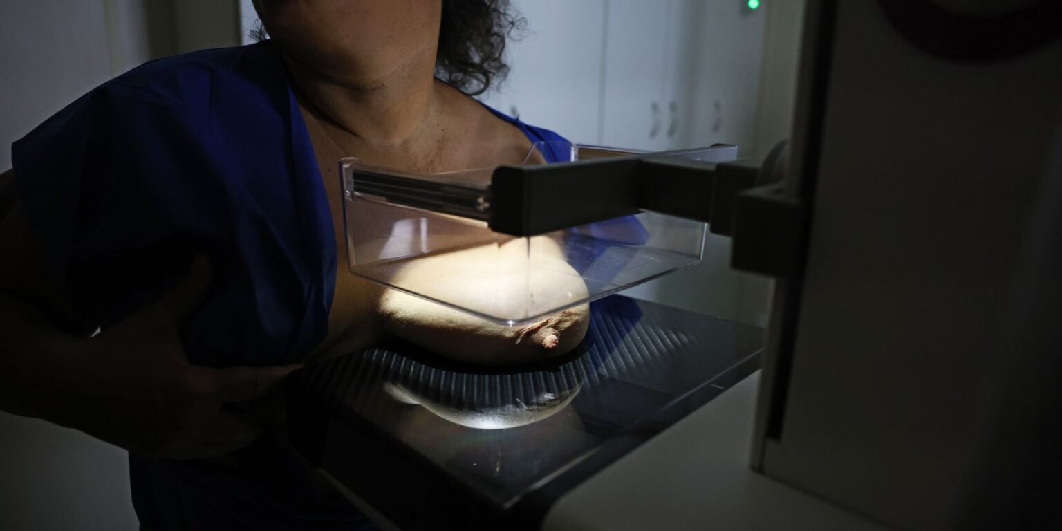 Mamografia: 92% das brasileiras de 50 a 69 anos fazem exame