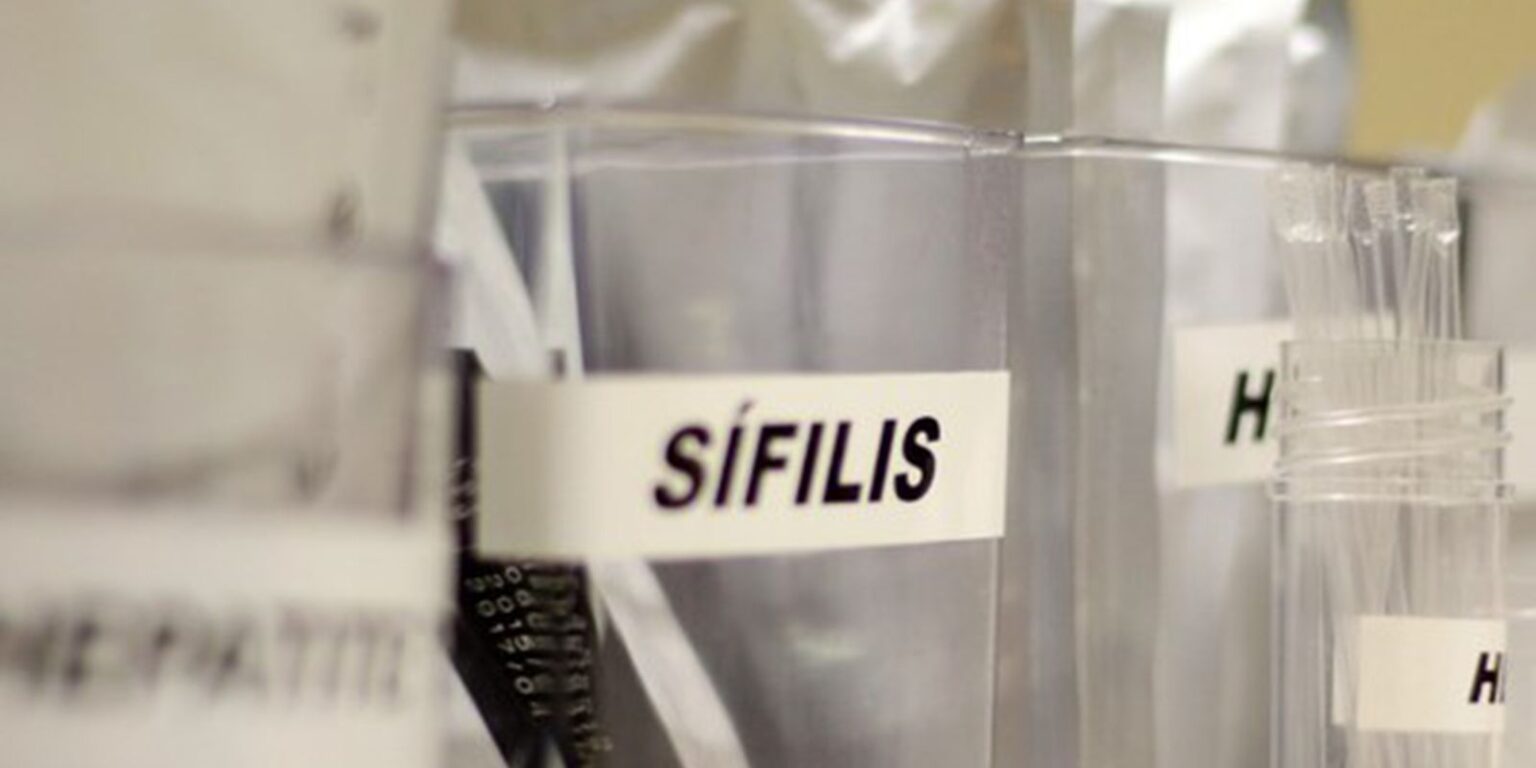 SUS adota antibiótico para prevenir sífilis e clamídia