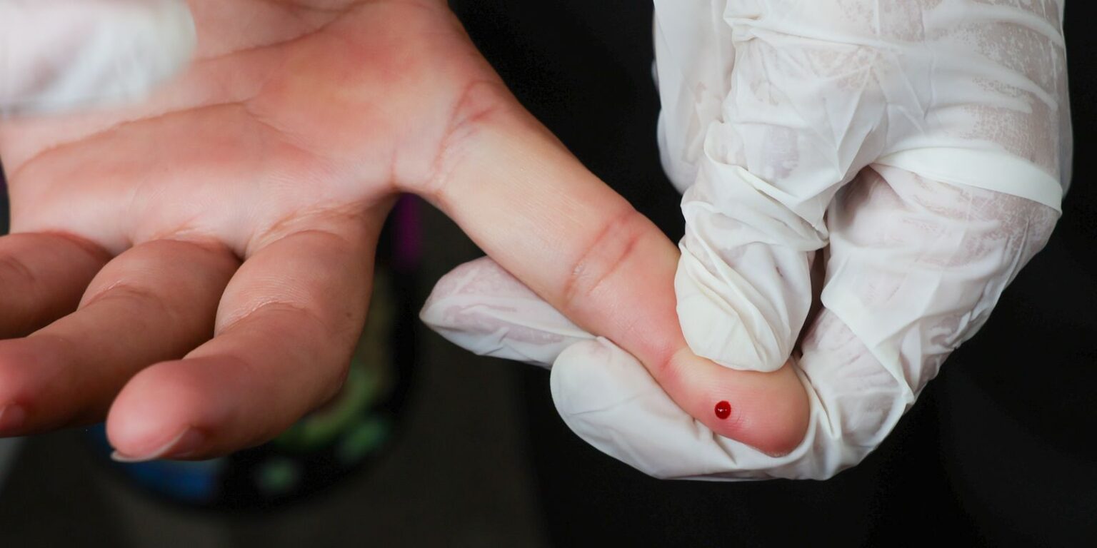 Teste rápido de dengue no SUS começa a ser oferecido em todo o país